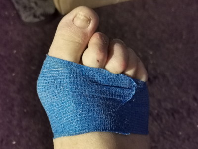 blue support bandage