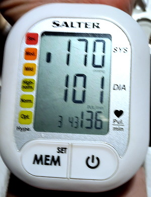very high
                                    pulse rate