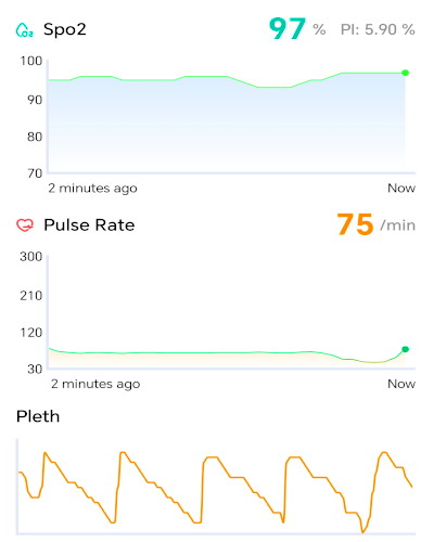 Oximeter on my phone